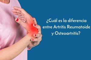tratamiento natural para osteoartritis